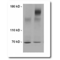 TRANSMEMBRANE PROTEIN EXTRACTION REAGENT (tmPER-100;  Membrane Protein Isolation)
